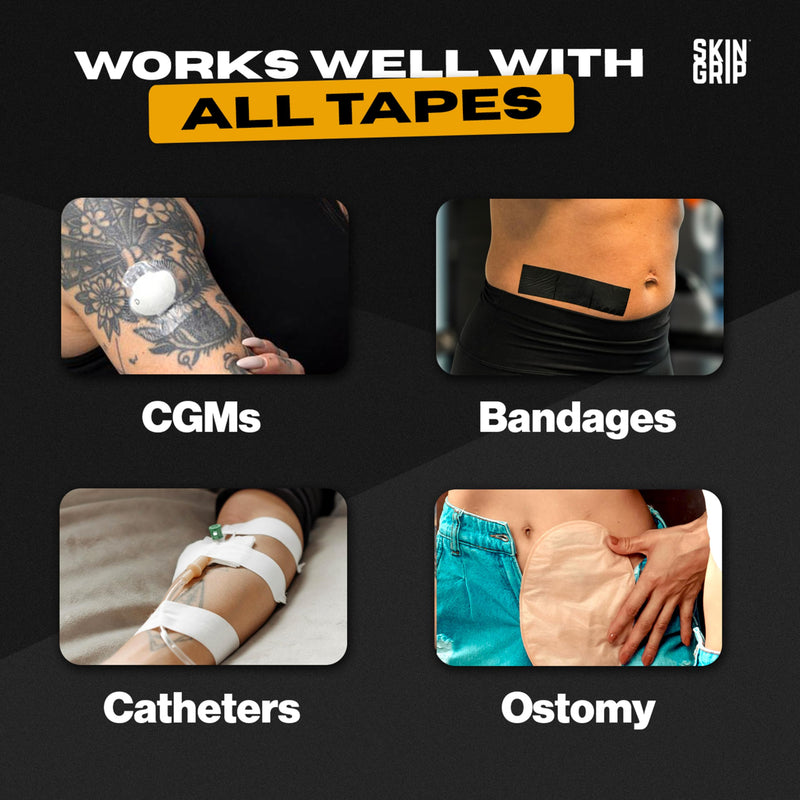 Skin Grip Adhesive Remover Wipes - 50 Ct | Medical Adhesive Remover for Skin | Dexcom Patch Removal | Skin-Friendly Adhesive Removal Wipes | Ostomy Adhesive Remover Wipes | CGMs & Sensor Cleanup