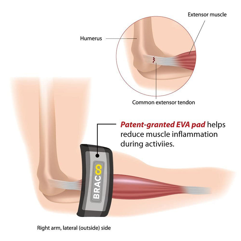 BRACOO EP40 Tennis Elbow Support Strap, Adjustable Brace with EVA Pad – Precise Clasp for Tennis/Golfer’s Elbow - BeesActive Australia