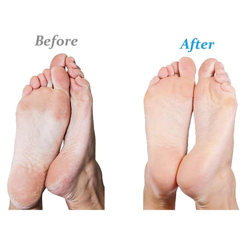 Emjoi Micro-Pedi Refill Rollers (Extra Coarse) - Pack of 4 - BeesActive Australia