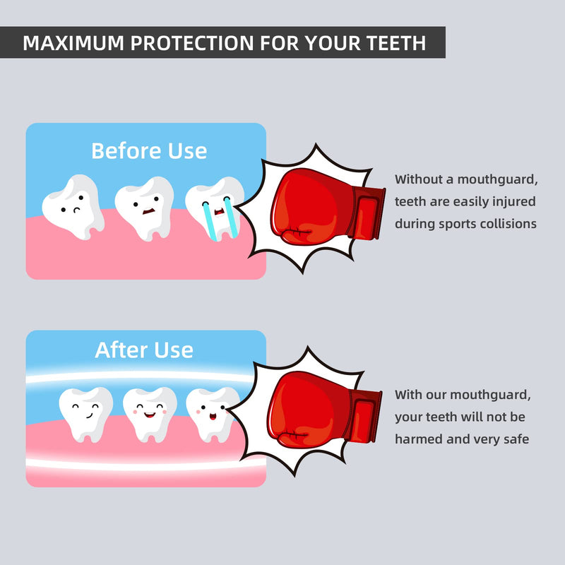 LPONJAR 5 Pack Kids Youth Mouth Guard for Sports, Child Teen Athletic Mouthguard with Case for Football Lacrosse Basketball Taekwondo Boxing MMA Rugby Karate Wrestling Small (under 9 Year old) - BeesActive Australia