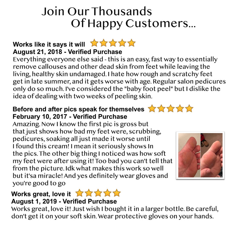 8oz Callus Remover Gel and Foot File/Foot Rasp Spa Kit. Professional Foot Care for dry, cracked heels. Soak in foot spa then apply callus gel to feet, and use foot scraper to peel off dead skin. - BeesActive Australia