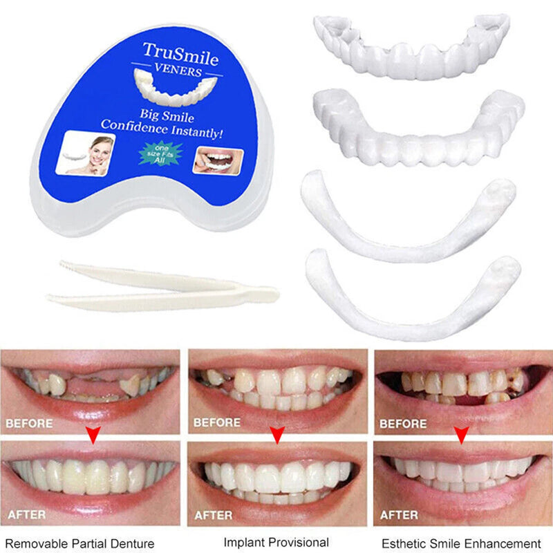 Snap On Veneers for Women & Men, Instant Smile Enhancer Cosmetic Teeth Covers, Natural White Temporary Dentures for Missing, Stained or Broken Teeth, Smile Restoration Kit with Portable Travel Case