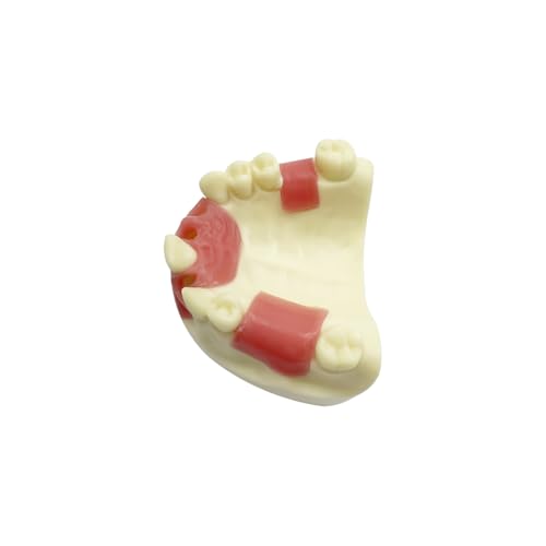 Dental Implant Practice Model, YOUYA DENTAL Maxillary Sinus Implant Model Dental Mandibular Sinus with Soft Gums for Dentist Student Studying Teaching Training Teaching Demonstration Clinic Model Maxillary Anterior Teeth Model