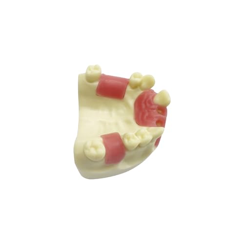 Dental Implant Practice Model, YOUYA DENTAL Maxillary Sinus Implant Model Dental Mandibular Sinus with Soft Gums for Dentist Student Studying Teaching Training Teaching Demonstration Clinic Model Maxillary Anterior Teeth Model