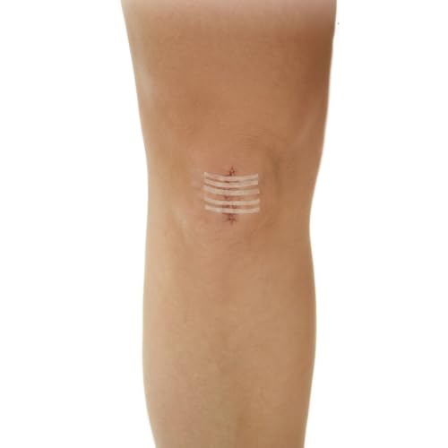 CURAD Sterile Medi-Strips Reinforced Wound Closures, 1/4" x 4", Hypoallergenic, Pack of 10 Strips