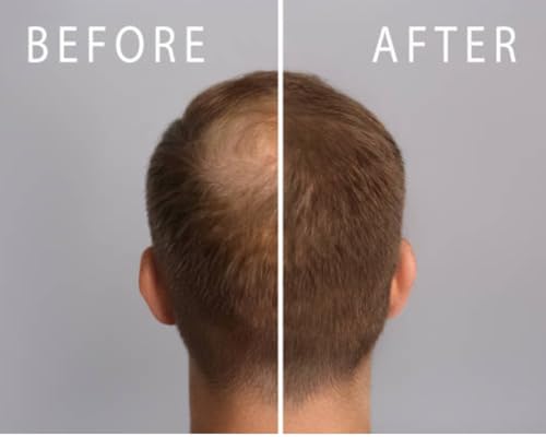 Hair Growth for Men and Women-Z-LAB27™ BioActive Plant Formula Awakens Hibernating Roots-Stimulates and Nourishes Scalp-Blocks DHT-Fuller Thicker Hair-Made in USA