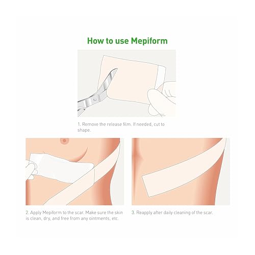 Mepiform 5x7.5 cm bandage 5 pcs