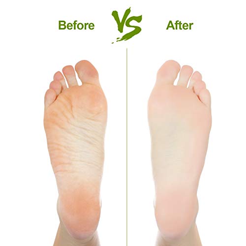 2PCS Natural Pumice Stone, Asqraqo Lava Pedicure Tools Hard Skin Callus Remover for Feet and Hands - Foot File Exfoliation to Remove Dead Skin, and Callusess 2 Count (Pack of 1)