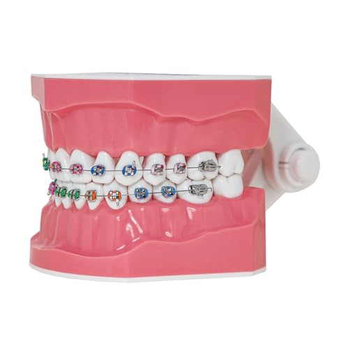 Typodonts Orthodontics Demonstration Model with Metal Wires and Bracket Teaching, Learning, Interpretation Model for Adults and Children (Metal Bracket) (Pack of 2) 7010-2 (Pack of 2)