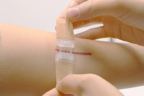 Laceration Wound Closure Device, Emergency Laceration Closure Strips to Repair - Pack of 10 Units
