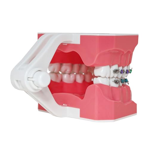 Typodonts Orthodontics Demonstration Model with Metal Wires and Bracket Teaching, Learning, Interpretation Model for Adults and Children (Metal Bracket) 7010-2