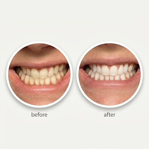 Smart Ash - Natural Charcoal Teeth Whitening Powder, Brightens Smile, Removes Surface Stains, Fluoride Free Toothpaste Alternative
