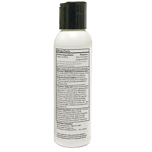 Naturasil Tinea Versicolor Treatment Lotion for Uneven Skin Tone - 4 oz Tinea Lotion