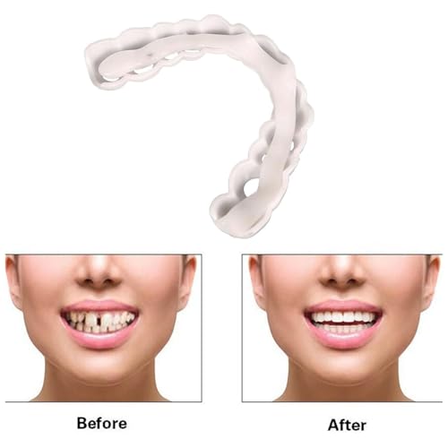 2 Pairs Beginner-Friendly Smile Tuning Kit, Tool-Free Shaping, Unisex Reusable Universal Daily Pack (Bright White) Bright White