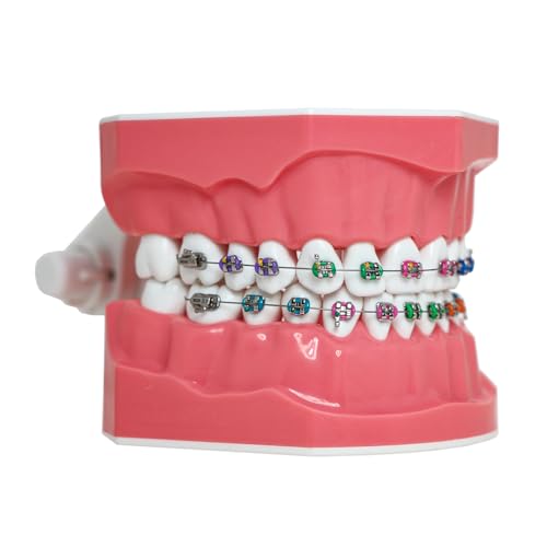 Typodonts Orthodontics Demonstration Model with Metal Wires and Bracket Teaching, Learning, Interpretation Model for Adults and Children (Metal Bracket) 7010-2