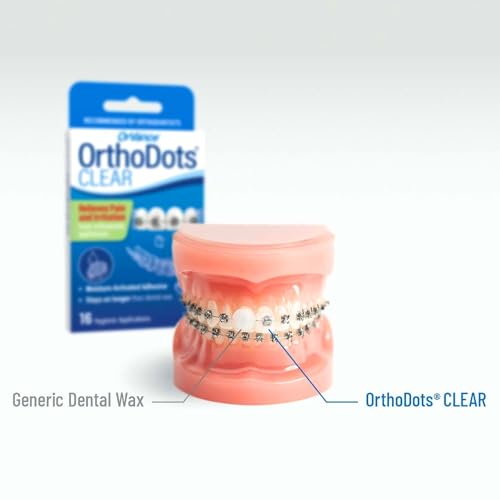 OrthoDots CLEAR – 24-Hour Protection | Sticks Better than Dental Wax | Moisture Activated Braces Wax Alternative for Pain Caused by Braces, Clear Aligner Trays, and Other Orthodontic Appliances 12 Count (Pack of 4)