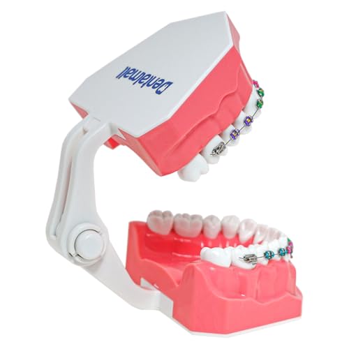 Typodonts Orthodontics Demonstration Model with Metal Wires and Bracket Teaching, Learning, Interpretation Model for Adults and Children (Metal Bracket) 7010-2