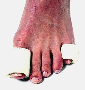 Dr. Jill's Foot Pads, Y2050, Tubefoam, 3 Inch Pieces, 16 Count, Size Small, 5/8"