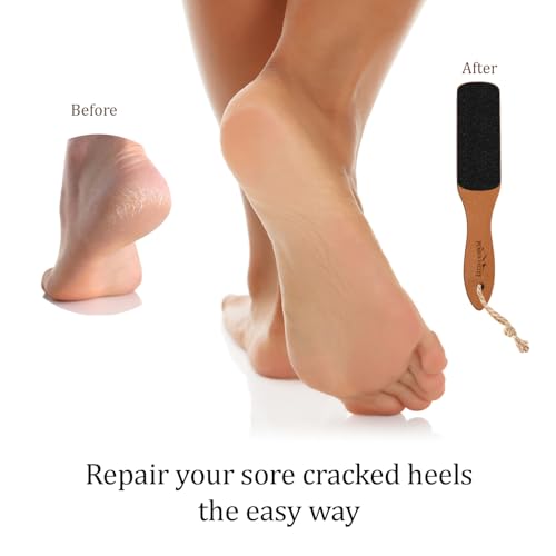 Foot File with Handle Pumice Stone for Dry Dead Skin - Callus Remover for Feet Double-Sided Foot File for Callus, Cracked Heels, Dead, and Dry Skin Removal