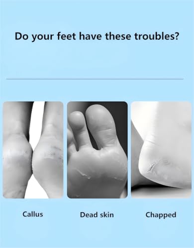 Professional Stainless Steel Foot File, Detachable Pedicure Rasp, Colossal Foot Scrubber for Hard Skin Removal, Wet and Dry Use