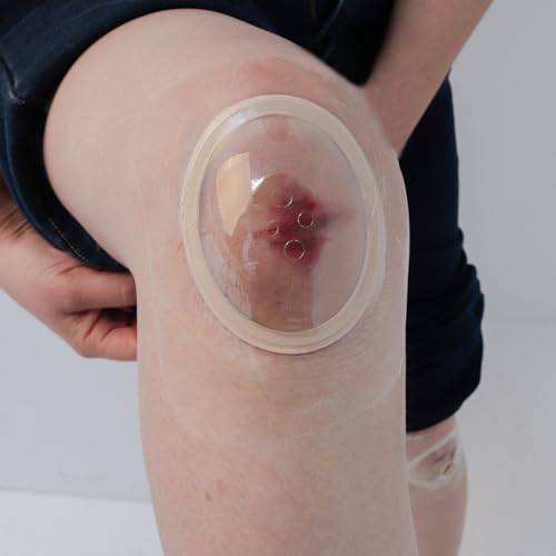 ANDAZZI Premium Wound Protection Cap, Large Size Transparent Protective Cap – Dome Shield for Wound Care & General Protection, 3-Caps + 10 Removable Waterproof Films (General Protection)