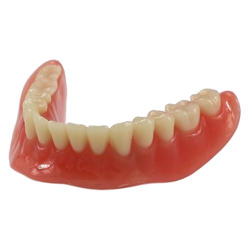 Dental Implant Restoration Model Mandibular Overdenture with 2 Implants