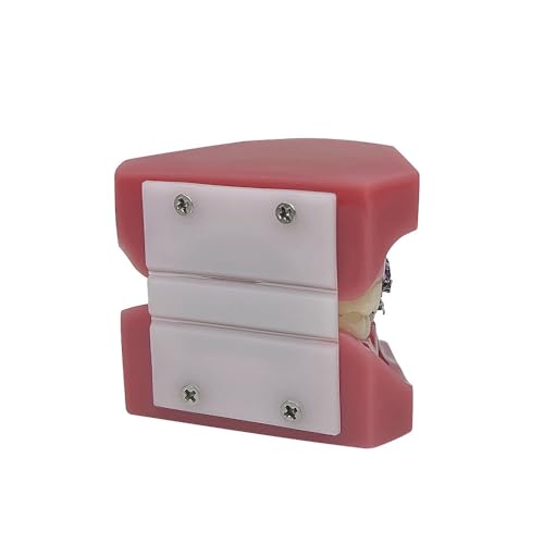 Orthodontic Model, YOUYA DENTAL 1/4 Metal self-Locking Comparison Orthodontic Model Orthodontic Tooth Model Dental Teaching Teeth Model with Metal Braces Bracket for Dentist Teaching Tools to Display 1/4 Metal self-Locking Model
