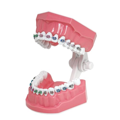 Typodonts Orthodontics Demonstration Model with Metal Wires and Bracket Teaching, Learning, Interpretation Model for Adults and Children (Metal Bracket) 7010-2