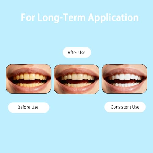 Dental Enamel Care Tooth Armor| Nano Hydroxyapatite Complex| Enamel Support Oral Care Drops,60ml (2) 2