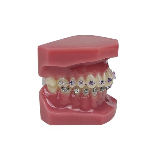 Orthodontic Model, YOUYA DENTAL 1/4 Metal self-Locking Comparison Orthodontic Model Orthodontic Tooth Model Dental Teaching Teeth Model with Metal Braces Bracket for Dentist Teaching Tools to Display 1/4 Metal self-Locking Model