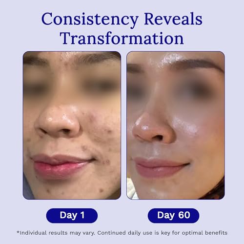 Rejuvaskin RejuvaSil Silicone Scar Gel, Scar Treatment for Surgical Scars, Burns, Keloids, Acne Scars on Face & Body, 30ml 1.01 Fl Oz (Pack of 1)