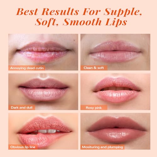ANAI RUI Lip Scrub & Lip Mask Gift Set, Peach PEACH-Xmas