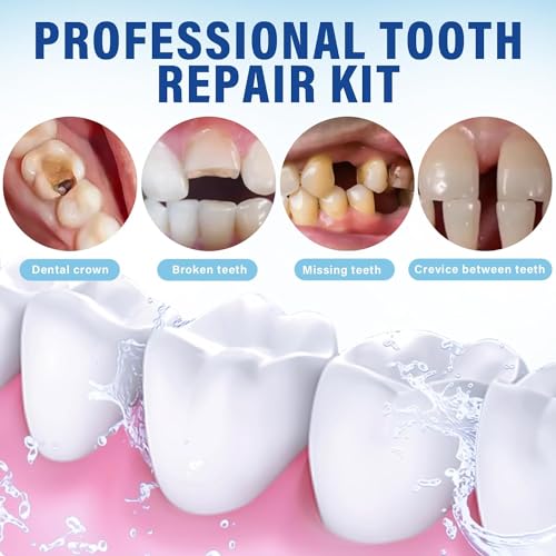 Zinc oxide-eugenol Cement Dental Kit affix temporary crowns or bridges