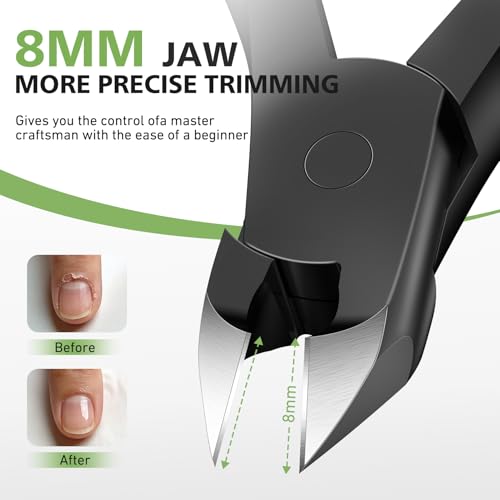 BALUCA Nail Cuticle Trimmer – Professional Stainless Steel Cuticle Clippers Nail Cuticle Remover Tool, Precision Nail Nippers Professional for Dead Skin, Cuticle Cutter with Ergonomic Handle (Black) Black