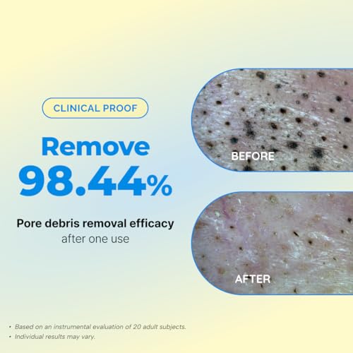 Seedlab Seed& Rice Glow Reset Cleanser - Korean Rice Face Wash for Exfoliating, Deep Cleansing&Pore Care - Gentle Daily Facial Cleanser - Dermatologist Tested K-Beauty Skincare
