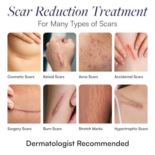 Silicone Scar Sheets