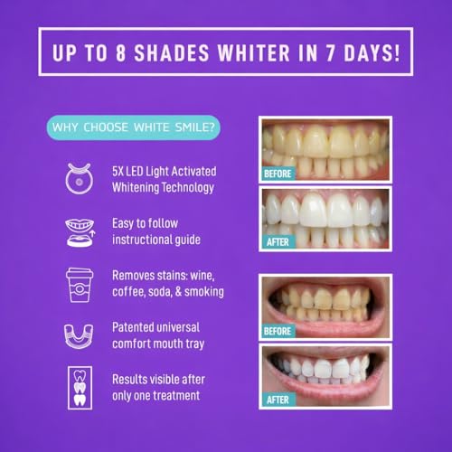 White Smile Teeth Whitening Kit with LED Light System, 35% Carbamide Peroxide, 3 Gel Syringes, Mouth Tray, 10-Minute Treatment, Non-Sensitive Formula, Stain Removal, Whitens up to 10 Shades in 7 Days
