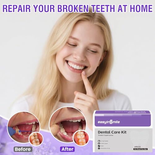 Tooth Repair Kit for Broken Teeth, Dental Cement Temporary Filling Zinc Oxide Eugenol Glue for Chipped Missing Teeth,Crowns & Bridges White