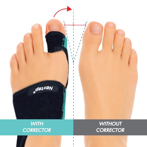 Bunion Corrector for Women, Big Toe Focused – Adjustable Knob Pair, Precision Big Toe Straightener & Separator, Soft Silicone Pads & Shoe Inserts for Females