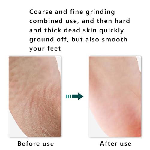 Foot rasp Foot File and Callus Remover. Best Foot Care Pedicure Surface Tool to Remove Hard Skin. Can be Used on Both Wet and Dry feet,Wood Foot File