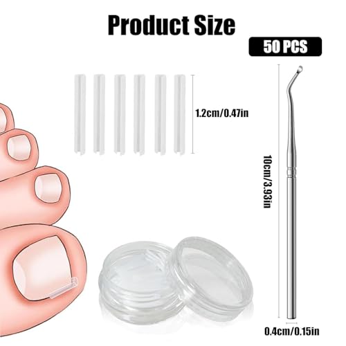 50 Pcs Ingrown Toenail Corrector Set, Toenail Correction Strips Brace Kit, Ingrown Toenails Correction Pad Recover Clips, Toenails Straightener Strips for Women Men's Nail Treatment Pedicure