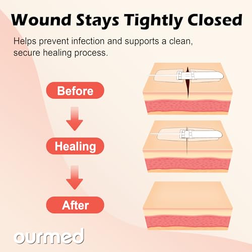Ourmed Wound Closure Strips(2.4"x 2.8" - 4 Pcs), Butterfly Bandages for Wound Care, Steri Emergency Laceration Closures Without Stitches for Outdoors Use 2.4x 2.8 Inch