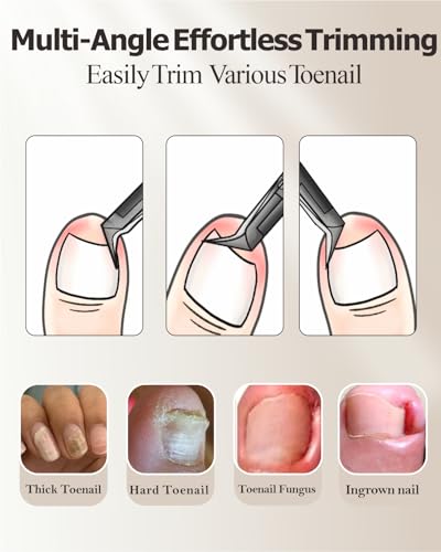 Heavy Duty Podiatrist Toenail Clippers for Thick and Ingrown Nails, Super Sharp and Effort-Saving Toe Nail Clippers, Safe Stainless Steel Ingrown Toenail Tool with Curved Blade for Seniors, Adults Black