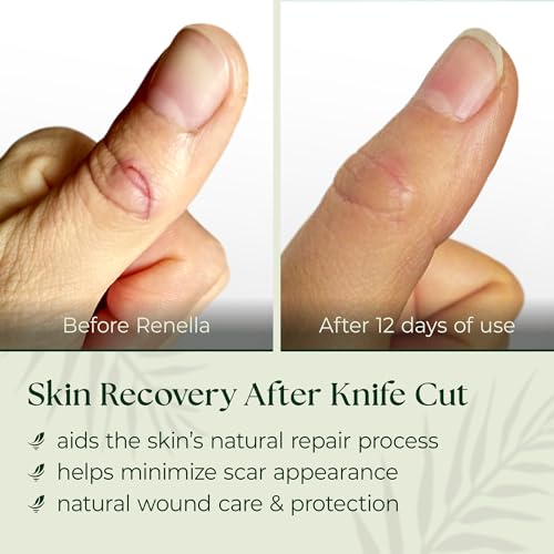 SCARLESS SKIN RECOVERY NATURAL FIRST AID GEL for Burns & Wounds First Aid Gel for Cuts, Scrapes & Burns – Advanced Skin Repair Ointment Soothing Film-Forming Barrier – Fragrance-Free