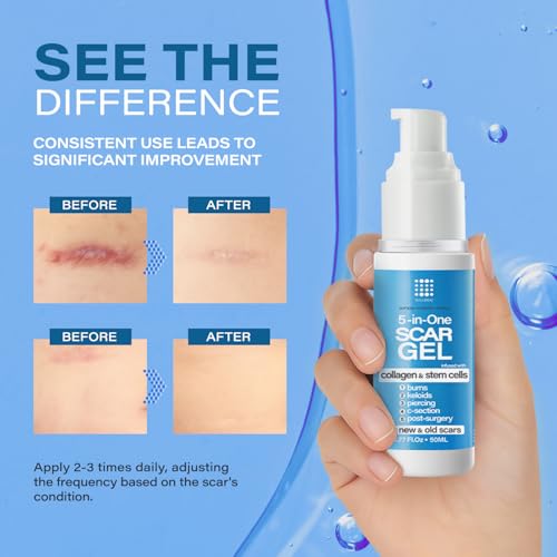 Bruizex 5-in-1 Scar Cream for Surgical Scars, Advance Silicone Gel, 50g