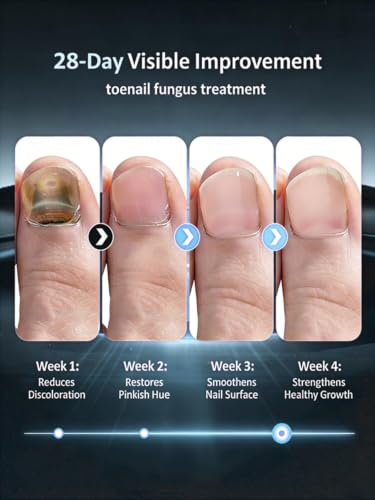 2026 Upgrade Toenail Fungus Treatment【Maximum Undecylenic Acid & Tea Tree】 White-3 Pack