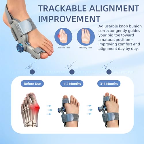 Bunion Corrector for Women & Men, Adjustable Big Toe Straightener