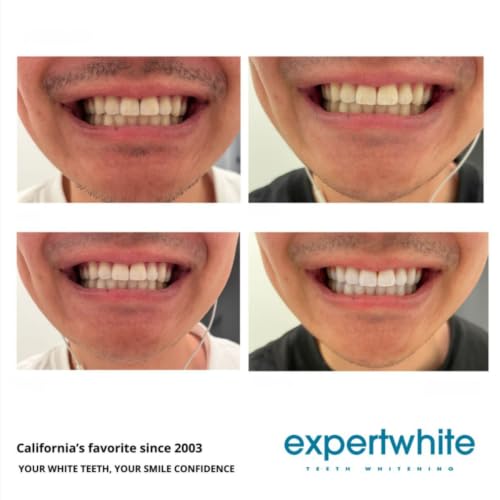 THE Strips™ by Expertwhite - Teeth Whitening Strips – 12% Hydrogen Peroxide, 30-Minute Treatment. Stay-in-Place Technology, Enamel Safe, pH Balanced, 28 Strips (14-Treatments). One Month Supply.