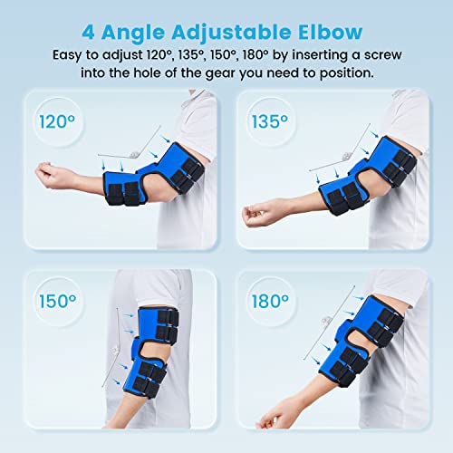 Elbow Splint Brace for Cubital Tunnel Syndrome and Ulnar Nerve Entrapment,New Upgraded with 4 Angles Adjustable,Fixed Elbow,Prevent Excessive Bending,for Men,Women,fits Left and Right Arm - S