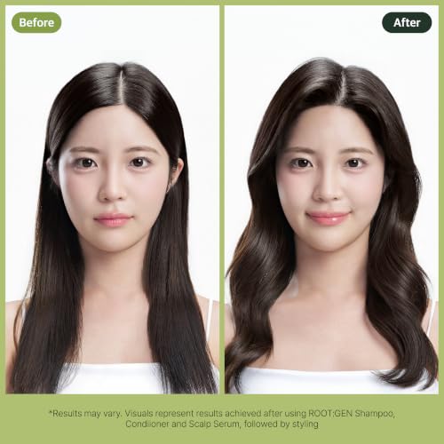 RYO ROOT:GEN Scalp Serum for Thinning Hair with Ginseng (2.7 Fl. Oz.) ROOT:GEN Scalp Essence